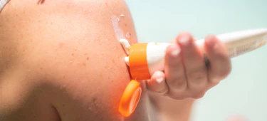 Suncare woman applies sunscreen to her arm outdoors